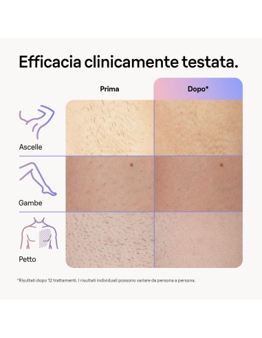 BRAUN PL7147 LUCE PULSATA